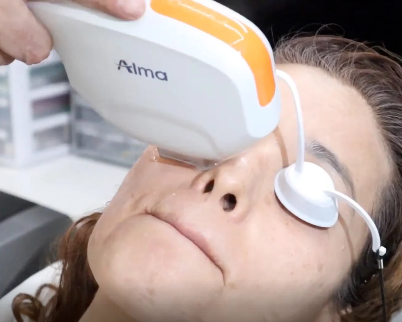 Harmony IPL · Haut Klinik