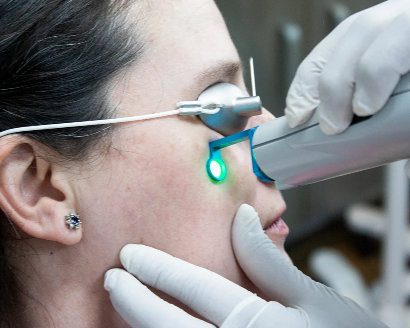 Láser Candela V-Beam · Haut Klinik