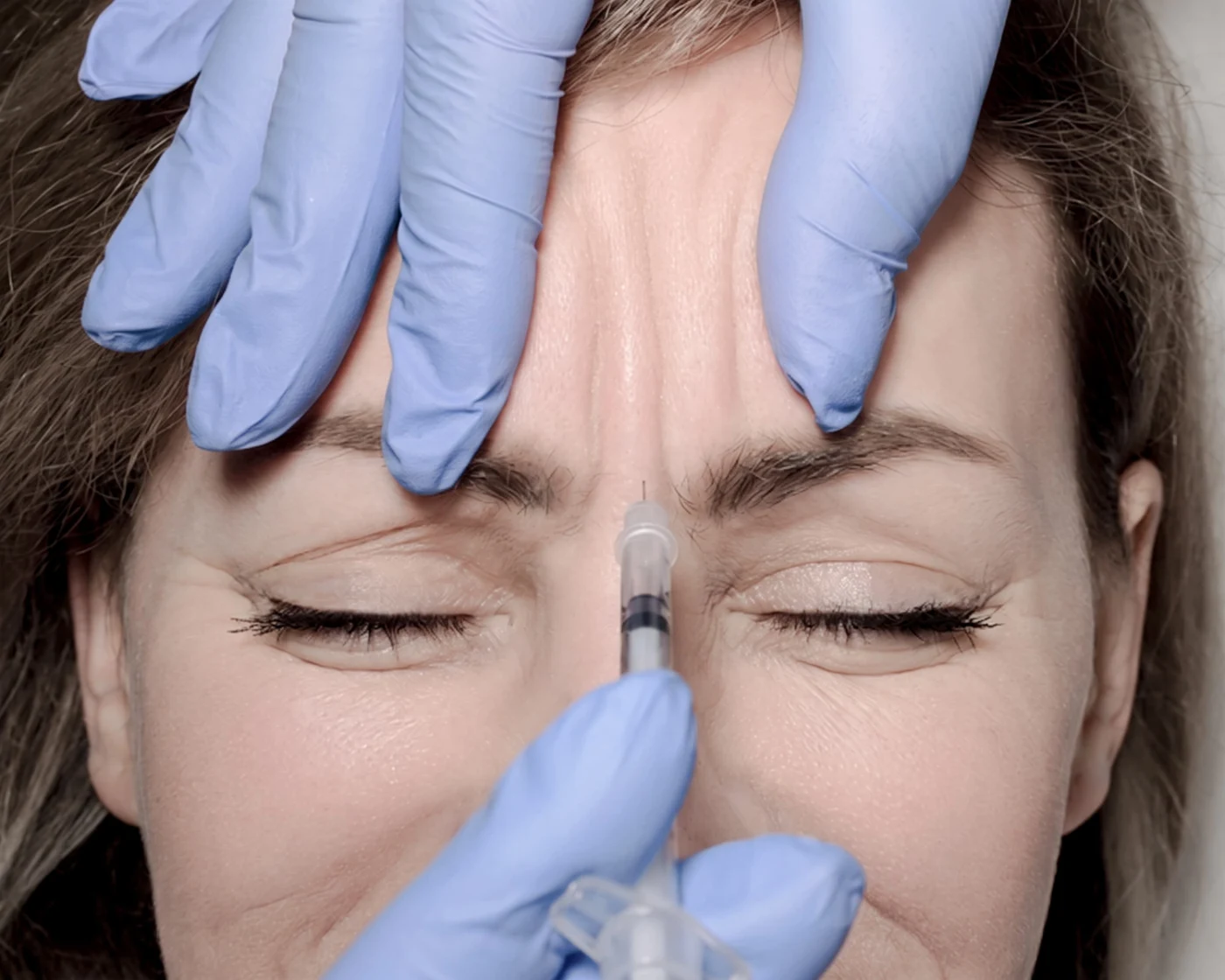 Acebloc · Haut Klinik