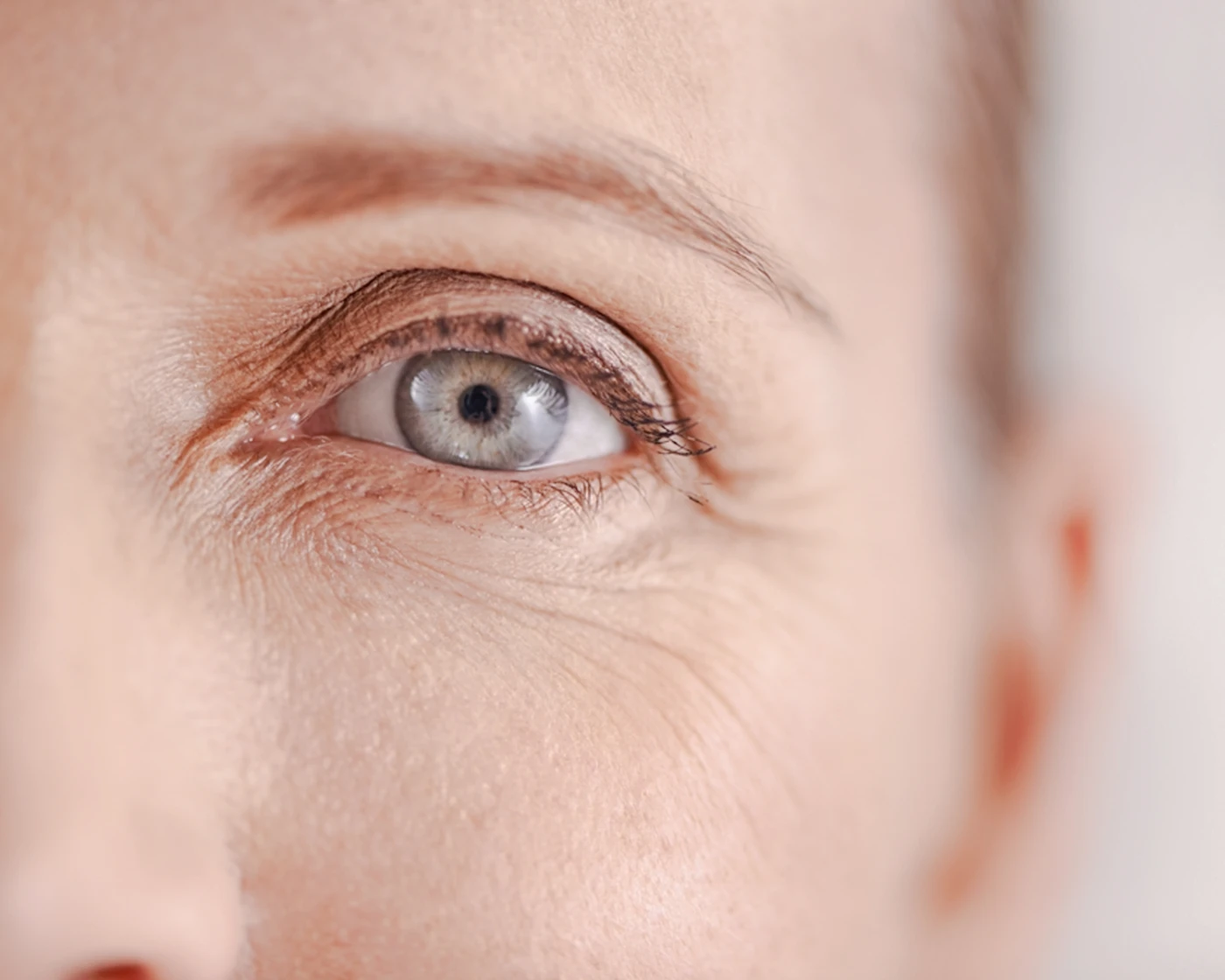 Líneas y arrugas · Haut Klinik